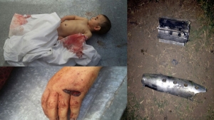 Dvogodi&scaron;nja azerbejdžanska devojčica i njena baka &ndash; nove žrtve jermenskih napada u Nagorno-Karabahu